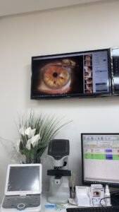 Dr Bengebara Omar – Ophtalmologue Fès