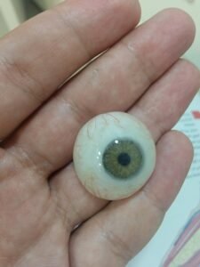  épithèse faciale "