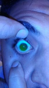 Zoom Optic